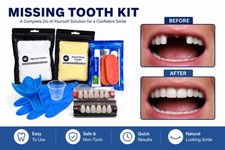 Missing Tooth Kit Replace Missing Front Teeth 1-6 at Home Partial Flipper Teeth picture
