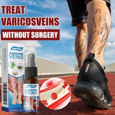 Leg Care Spray Varicose Vein Relief Circulation Booster Skin Nourishing 30ml picture