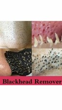10 pcs Blackhead White Or Black - Remover Nose Pore Cleansing Strips Peel Off picture