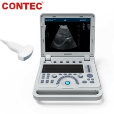 Ultrasonic Diagnostic System abdomen/convex probe CONTEC CMS600P2 PLUS+Free PW picture